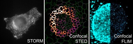 Super resolution and advanced microscopy imaging techniques